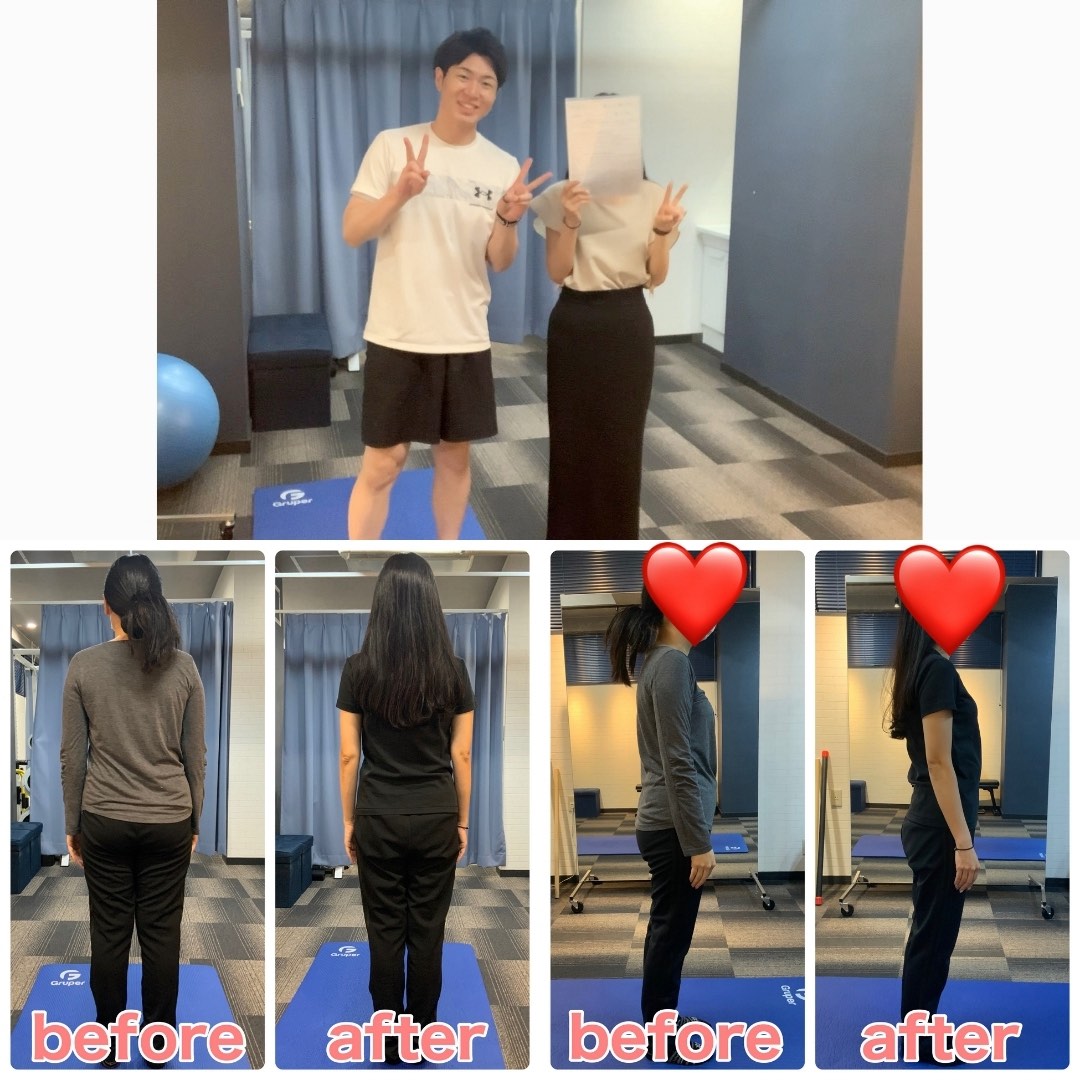 34歳女性のダイエットビフォーアフター