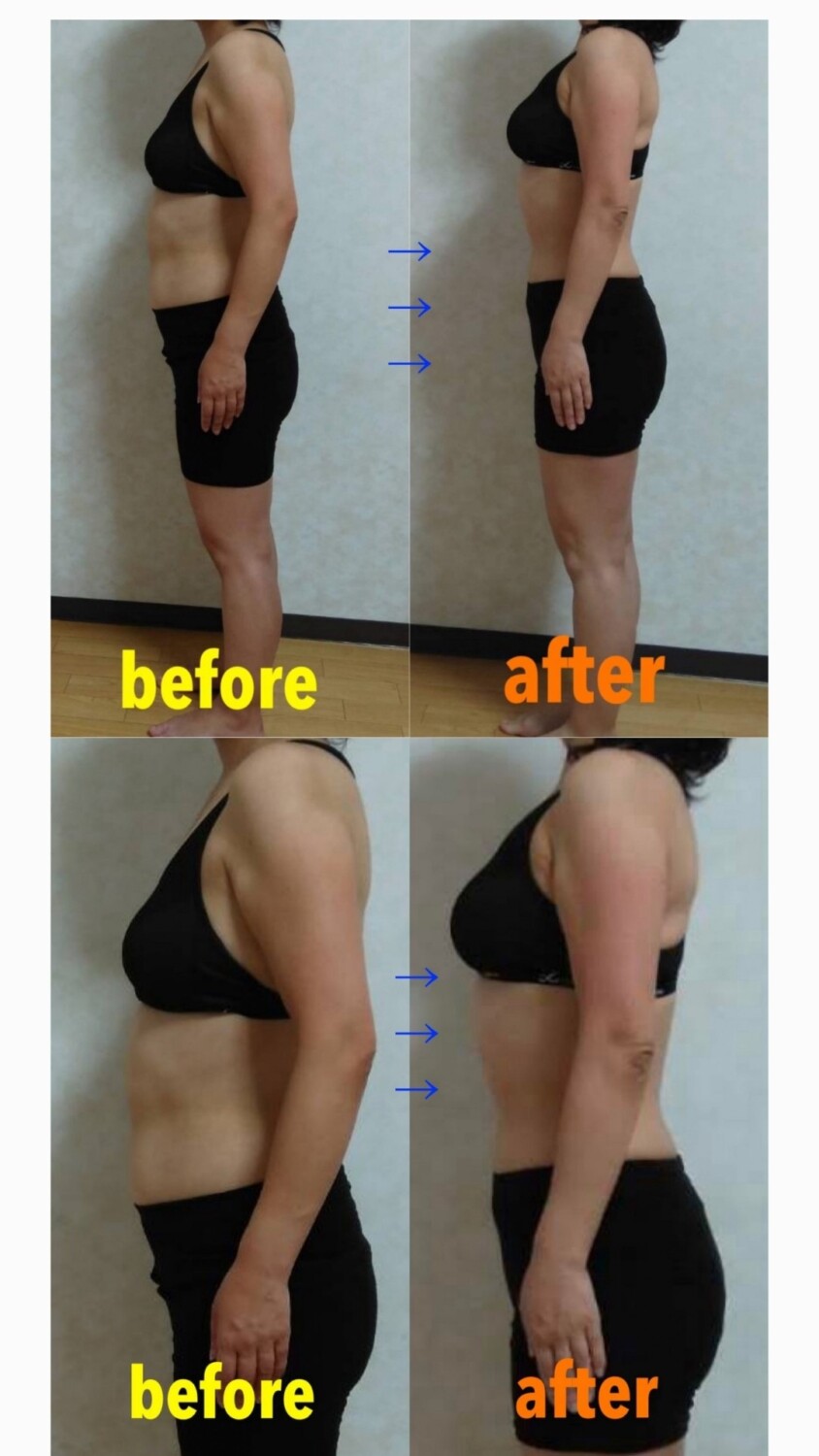 49歳女性のダイエットビフォーアフター
