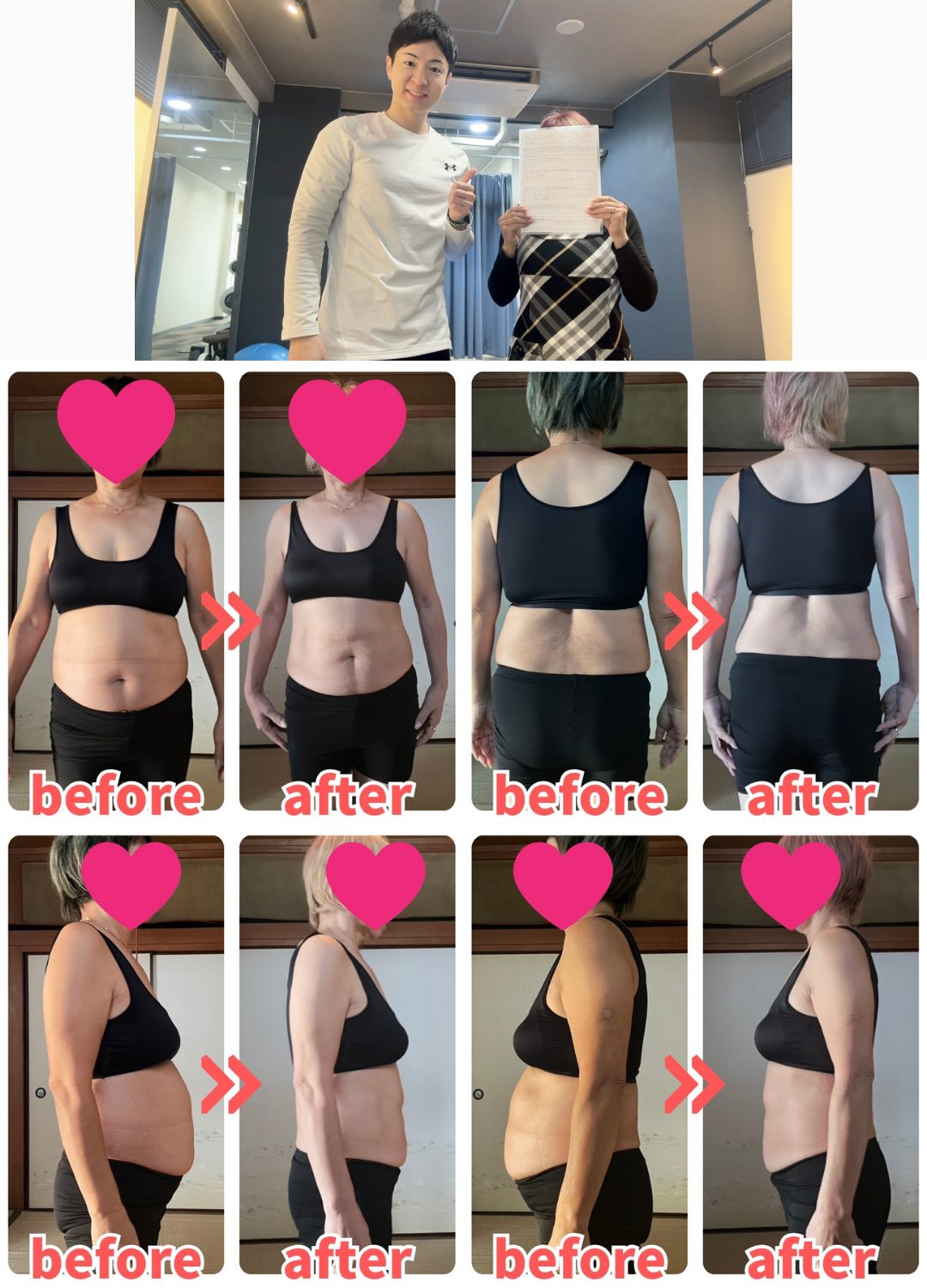 62歳女性のダイエットビフォーアフター