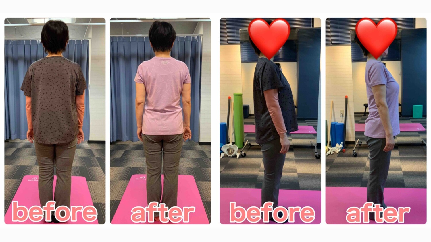 62歳女性のダイエットビフォーアフター