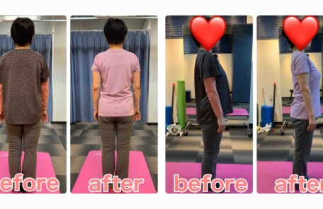 62歳女性のダイエットビフォーアフター
