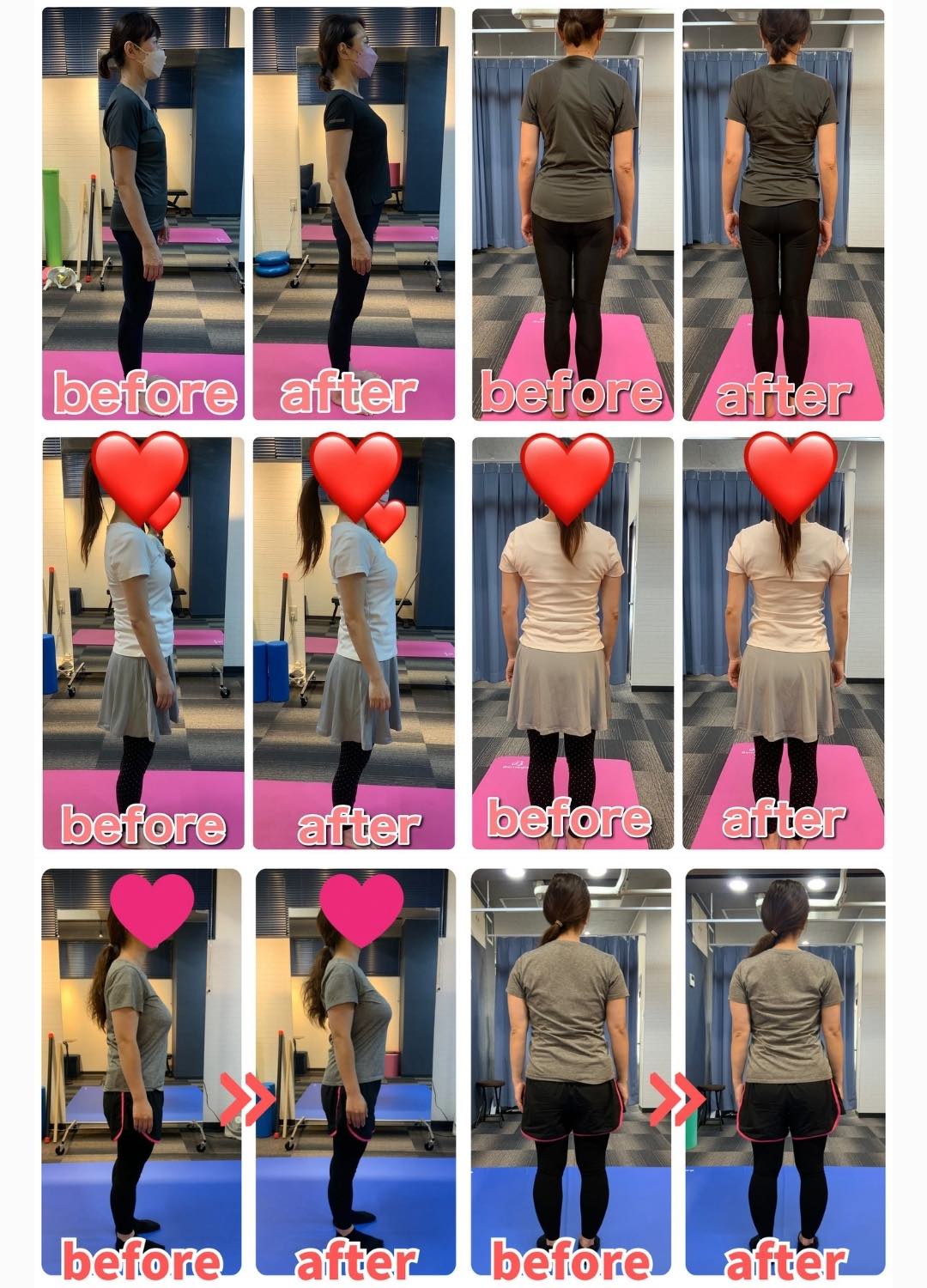 猫背と巻き肩が改善された女性のお客様のビフォーアフター3名分。背中のラインが整い、若々しい後ろ姿とバストアップ効果が見られる変化。広島のパーソナルトレーナーによる姿勢矯正トレーニングの成果。